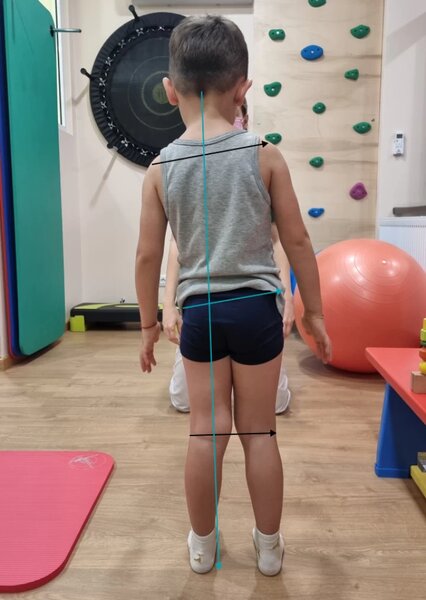 Empatio Clinica - Tratamente hernie de disc, articulatii, Durere spate, umar, genunchi, glezne, recuperare post- operatorie